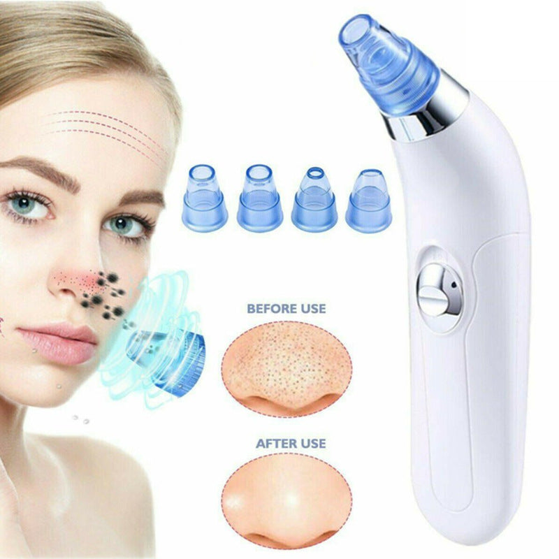 Blackhead Cleaner Pore Extraction Beauty Tool